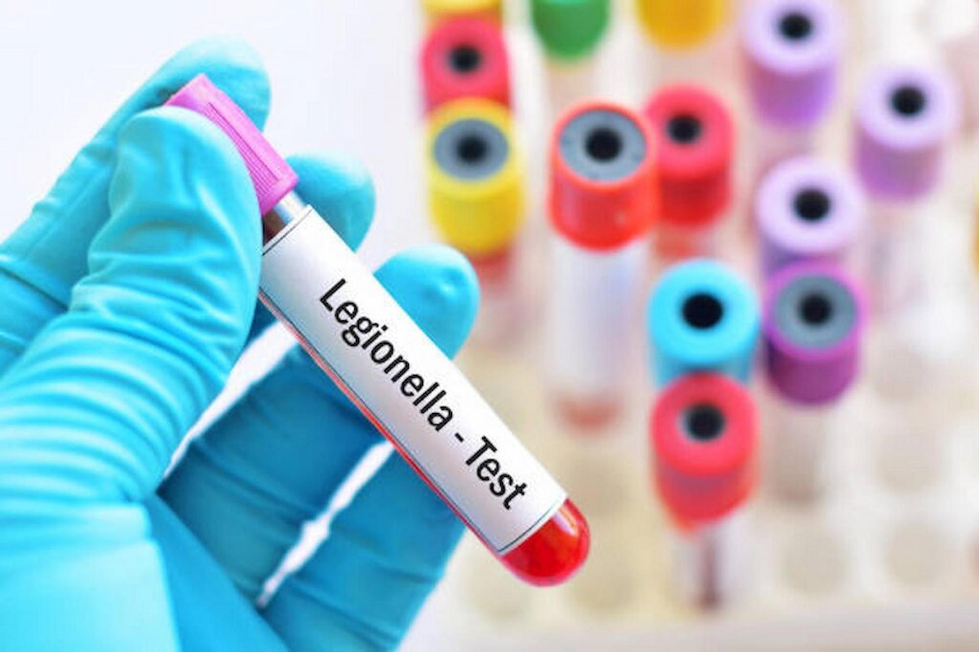 Businesses That Are Considered High Risk Of Legionella